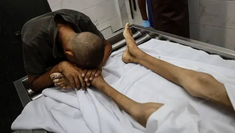 Gazze’de Yeni Bir Facia: Yetersiz Beslenmeden Bir Çocuk Daha Hayatını Kaybetti